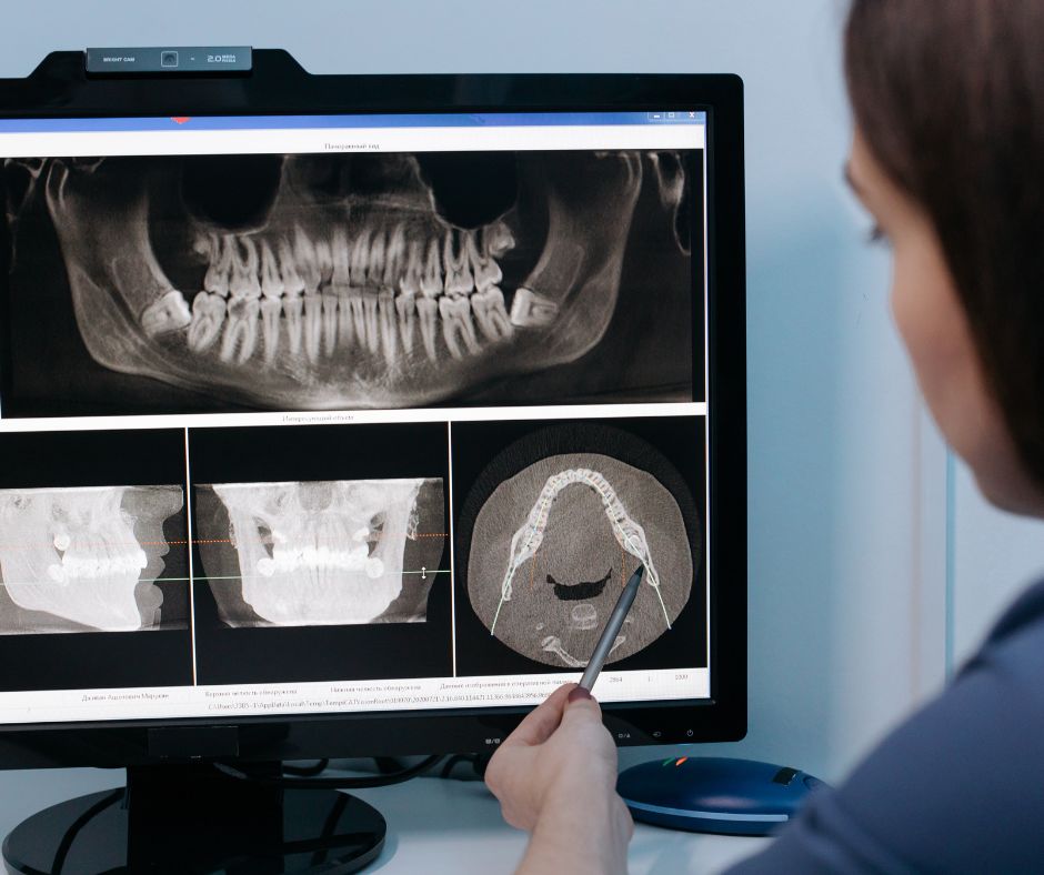 Хто лікує щелепний суглоб