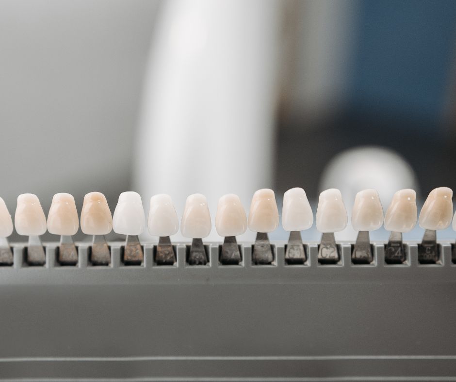 Як швидко вирівняти зуби без брекетів