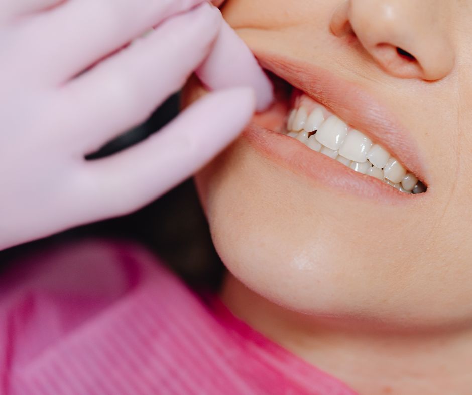 Чи можна ставити вініри на проблемні зуби