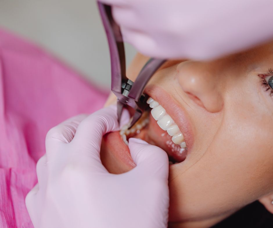 Наскільки терміново треба видаляти зуби мудрості?