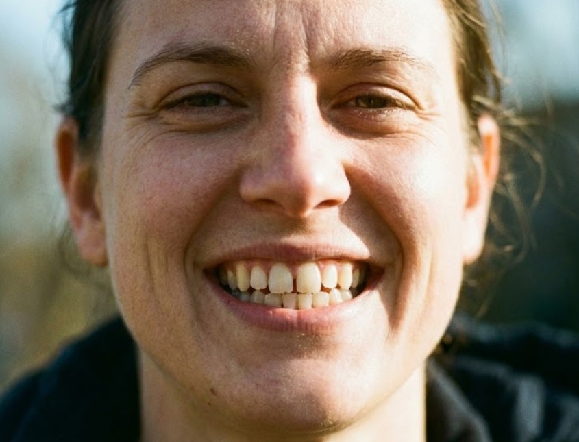 Що буде якщо прикус не вирівнювати